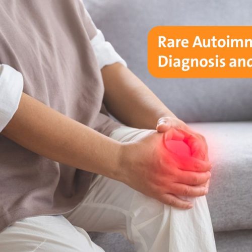 Rare Autoimmune Diseases: Diagnosis, Management, and Patient Care