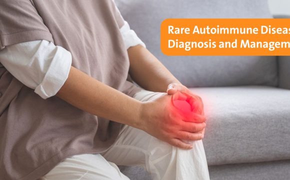 Rare Autoimmune Diseases: Diagnosis, Management, and Patient Care