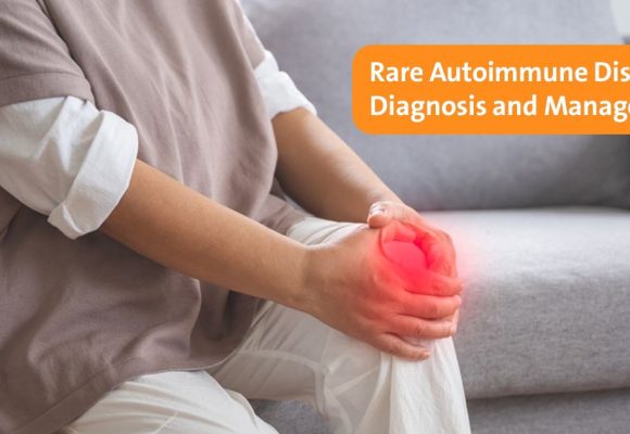 Rare Autoimmune Diseases: Diagnosis, Management, and Patient Care