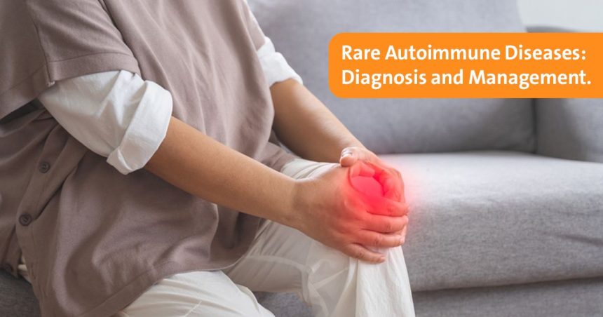 Rare Autoimmune Diseases: Diagnosis, Management, and Patient Care